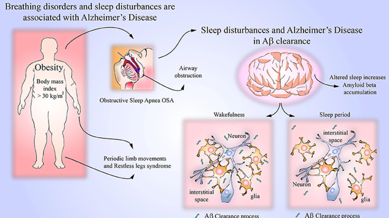 Delayed Sleep Phase Syndrome and the Impact on Physical Health